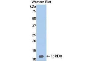 Western Blotting (WB) image for anti-Defensin, beta 1 (DEFB1) (AA 22-69) antibody (ABIN1174547) (beta Defensin 1 Antikörper  (AA 22-69))