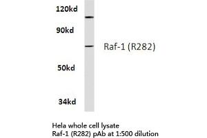 Western blot (WB) analysis of Raf-1 antibody in extracts from hela cells. (RAF1 Antikörper)