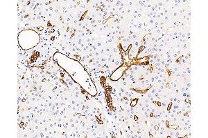 Immunohistochemistry analysis of paraffin-embedded human liver using AQP1 Polyclonal Antibody at dilution of 1:400. (Aquaporin 1 Antikörper)
