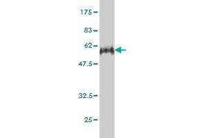 Western Blot detection against Immunogen (56. (E2F6 Antikörper  (AA 1-281))