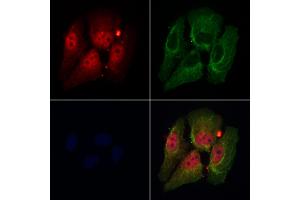 ABIN7094161 and ABIN7098205 staining Hela cells by IF/ICC. (DDX17 Antikörper  (C-Term))