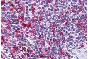 Human Spleen: Formalin-Fixed, Paraffin-Embedded (FFPE) (PCDH12 Antikörper  (N-Term))