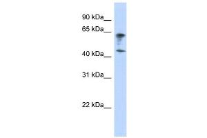 IGSF11 antibody used at 1 ug/ml to detect target protein. (IGSF11 Antikörper  (Middle Region))