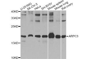 Western blot analysis of extracts of various cell lines, using ARPC3 Antibody (ABIN5974958) at 1/1000 dilution. (ARPC3 Antikörper)