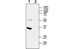 Western blot analysis of human U87-MG glioblastoma cell line lysate:1. (GIPC PDZ Domain Containing Family, Member 1 (GIPC1) Peptid)
