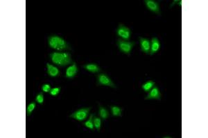 Immunofluorescence analysis of A549 cells using GTF2F2 antibody. (GTF2F2 Antikörper)
