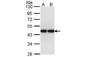 WB Image Sample (30 ug of whole cell lysate) A: Hep G2 , B: Molt-4 , 10% SDS PAGE antibody diluted at 1:1000 (Actin-Like 8 Antikörper)