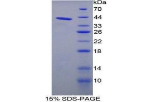 SDS-PAGE (SDS) image for Natriuretic Peptide Type C (NPPC) (AA 18-104) protein (His tag,GST tag) (ABIN1879843)