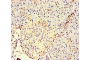 Immunohistochemistry (IHC) image for anti-Runt-Related Transcription Factor 1, Translocated To, 1 (Cyclin D-Related) (RUNX1T1) (AA 416-525) antibody (ABIN7165188)