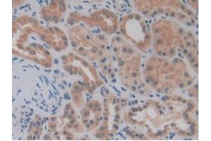 IHC-P analysis of Human Kidney Tissue, with DAB staining. (MMP14 Antikörper  (AA 112-321))