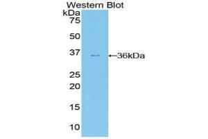 Western Blotting (WB) image for anti-V-Akt Murine Thymoma Viral Oncogene Homolog 2 (AKT2) (AA 142-412) antibody (ABIN1860233) (AKT2 Antikörper  (AA 142-412))