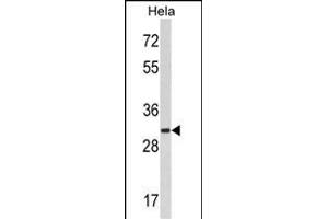 Western blot analysis of hRCKS- (ABIN389097 and ABIN2839288) in Hela cell line lysates (35 μg/lane). (MARCKS Antikörper  (C-Term))