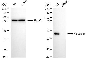 Western blotting analysis using Keratin 17 antibody (ABIN7799172). (Rekombinanter KRT17 Antikörper)