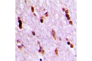 Immunohistochemical analysis of Ubiquilin 4 staining in human brain formalin fixed paraffin embedded tissue section.
