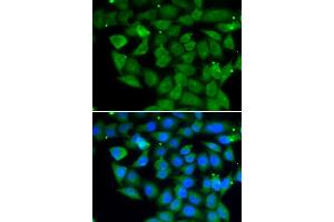 Immunofluorescence analysis of A549 cell using ELAC2 antibody. (ELAC2 Antikörper)