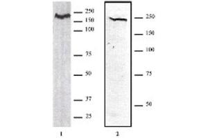 CHD1 antibody (pAb) tested by Western blot. (CHD1 Antikörper  (AA 251-467))