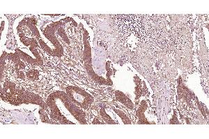 Immunohistochemistry (Paraffin-embedded Sections) (IHC (p)) image for anti-C-Type Lectin Domain Family 9, Member A (CLEC9A) (AA 101-200) antibody (ABIN1713465)
