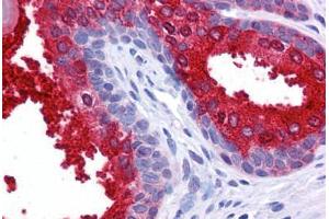 Human Prostate: Formalin-Fixed, Paraffin-Embedded (FFPE) (SCUBE2 Antikörper  (Internal Region))