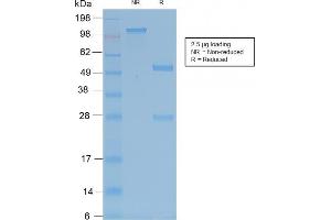 SDS-PAGE Analysis of Purified TRAcP Rabbit Recombinant Monoclonal Antibody (ACP5/2336R).