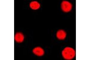 Immunofluorescent analysis of Estrogen Receptor 2 staining in HeLa cells. (ESR2 Antikörper  (Center))