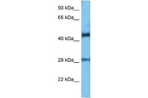 Host:  Mouse  Target Name:  ETV6  Sample Tissue:  Mouse Small Intestine  Antibody Dilution:  1ug/ml (ETV6 Antikörper  (C-Term))