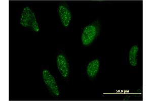 Immunofluorescence of monoclonal antibody to PPARA on HeLa cell. (PPARA Antikörper  (AA 1-258))