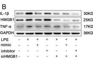 The effects of miR-339-5p and HMGB1-siRNA on LPS-induced RAW264. (IL-1 beta Antikörper  (AA 1-269))