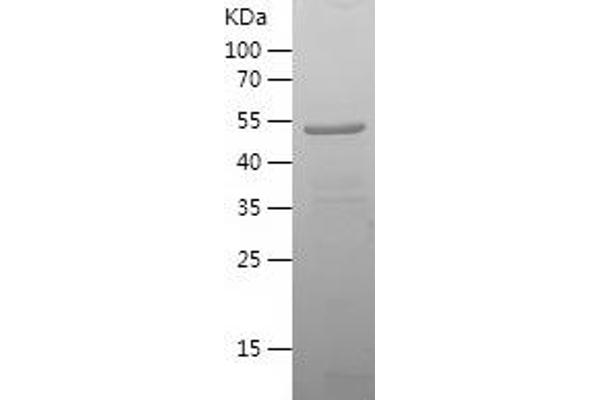 SLC20A1 Protein (AA 253-510) (His-IF2DI Tag)