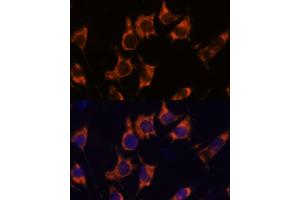 Immunofluorescence analysis of L929 cells using NDRG4 antibody  at dilution of 1:100. (NDRG4 Antikörper  (AA 140-220))