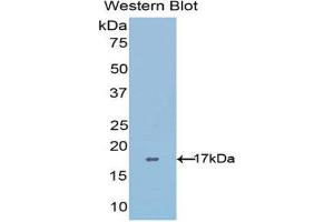 Western Blotting (WB) image for anti-ADAM Metallopeptidase with Thrombospondin Type 1 Motif, 4 (ADAMTS4) (AA 437-575) antibody (ABIN1077726) (ADAMTS4 Antikörper  (AA 437-575))