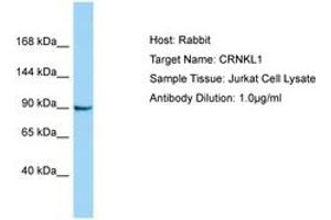 Image no. 1 for anti-Crooked Neck Pre-mRNA Splicing Factor-Like 1 (CRNKL1) (AA 760-809) antibody (ABIN6750173) (CRNKL1 Antikörper  (AA 760-809))