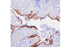 Anti-Annexin A1 antibody, IHC(P) IHC(P): Human Tonsil Tissue (Annexin a1 Antikörper  (N-Term))