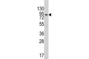 Western Blotting (WB) image for anti-Cadherin 5 (CDH5) (AA 106-134) antibody (ABIN3030247)