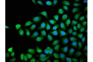 Immunofluorescence staining of Hela cells with ABIN7168754 at 1:66, counter-stained with DAPI. (DVL3 Antikörper  (AA 509-696))