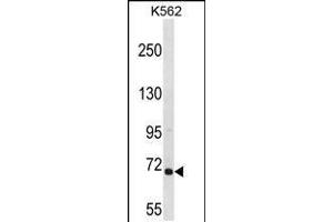 Western blot analysis in K562 cell line lysates (35ug/lane). (ARHGEF6 Antikörper  (C-Term))