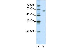 WB Suggested Anti-PBX2  Antibody Titration: 1. (PBX2 Antikörper  (C-Term))