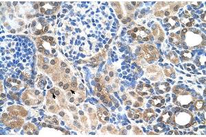 Immunohistochemistry (IHC) image for anti-Solute Carrier Family 22 (Organic Cation Transporter), Member 7 (SLC22A7) (C-Term) antibody (ABIN2775547)
