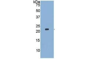 Western Blotting (WB) image for Matrix Metallopeptidase 13 (Collagenase 3) (MMP13) ELISA Kit (ABIN6730928)