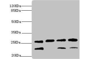 DR1 抗体  (AA 1-176)