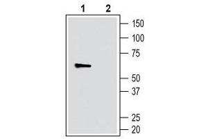 Western blot analysis of human THP-1 monocytic leukemia cells: - 1. (SLC11A1 Antikörper  (4th Extracellular Loop))