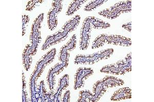 IHC analysis of TXN2 using anti-TXN2 antibody (ABIN7602150). (TXN2 Antikörper  (AA 60-166))
