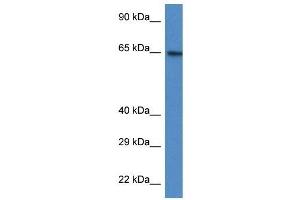 Western Blot showing ACSS2 antibody used at a concentration of 1 ug/ml against HT1080 Cell Lysate (ACSS2 Antikörper  (N-Term))