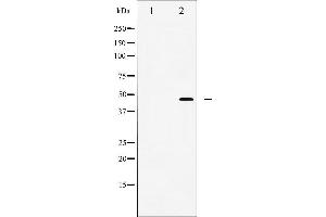 Western Blotting (WB) image for anti-Wingless-Type MMTV Integration Site Family, Member 1 (WNT1) (C-Term) antibody (ABIN6266035)