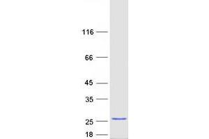 Validation with Western Blot (ANKRD39 Protein (Myc-DYKDDDDK Tag))
