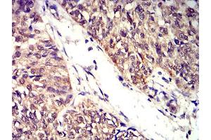 Immunohistochemistry (IHC) image for anti-butyrophilin, Subfamily 2, Member A2 (BTN2A2) (AA 57-237) antibody (ABIN5611320)
