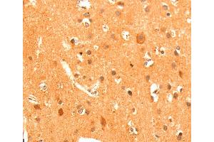 Immunohistochemistry (IHC) image for anti-Glutamate Receptor, Metabotropic 3 (GRM3) antibody (ABIN2428189) (Metabotropic Glutamate Receptor 3 Antikörper)