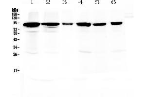 Western blot analysis of Periostin using anti-Periostin antibody .