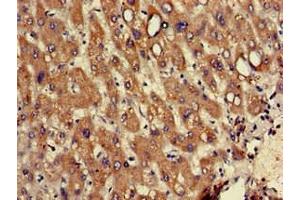 Immunohistochemistry of paraffin-embedded human liver tissue using ABIN7142740 at dilution of 1:100 (RPL12 Antikörper  (AA 1-99))