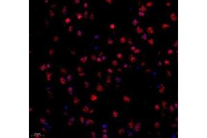Immunofluorescence of paraffin embedded mouse corpus striatum using STRAD (ABIN7075730) at dilution of 1: 600 (400x lens) (STRADA Antikörper)