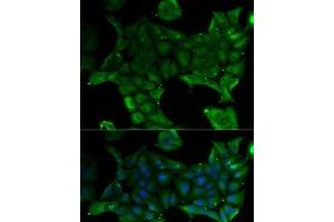 Immunofluorescence analysis of U2OS cells using SLC34A1 Polyclonal Antibody